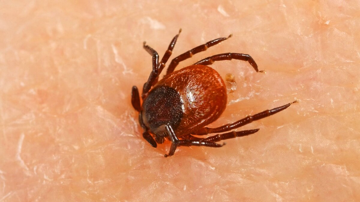    Как убрать клеща без медицинской помощи