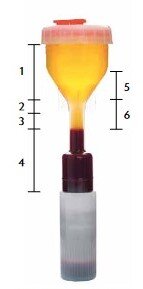 Фото 1. PRP-пробирка Ycellbio-Kit.  1 — РРР — плазма, бедная тромбоцитами (55 %)
 2 — PRP — плазма, богатая тромбоцитами
 3 — Buffy Coat — плазма, богатая тромбоцитами и лейкоцитами
 4 — эритромасса (44 %)
 5 — PRGF (LPRP + PPP) — плазма, богатая тромбоцитами, факторами роста и цитокинами
 6 — LPRP (PRP + Buffy Coat) (1 %)