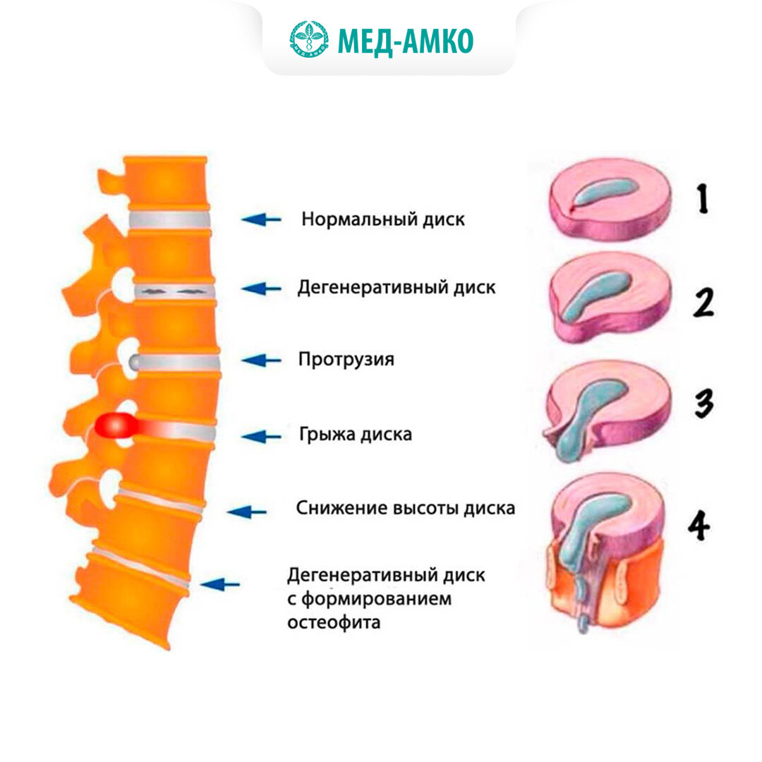 Массаж спины с медом