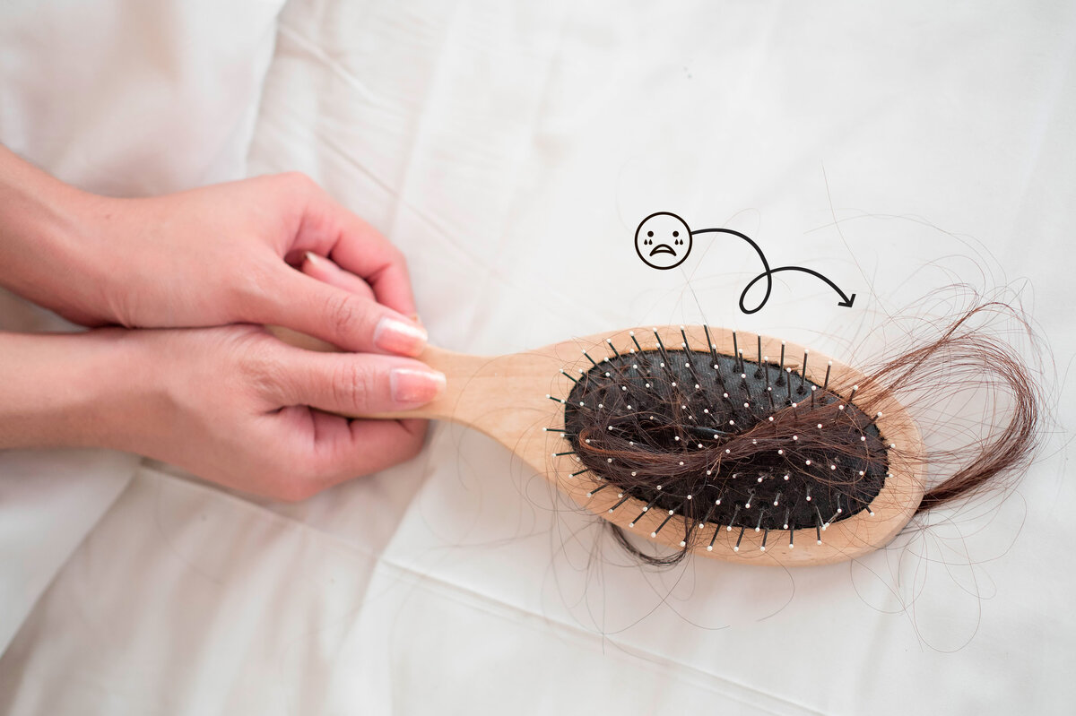     Это психосоматика! 5 странных причин выпадения волос, на которые ты бы и не подумала