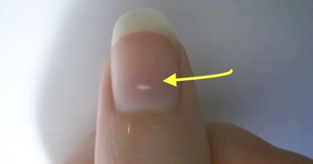 Источник: wl-adme.cf.tsp.li