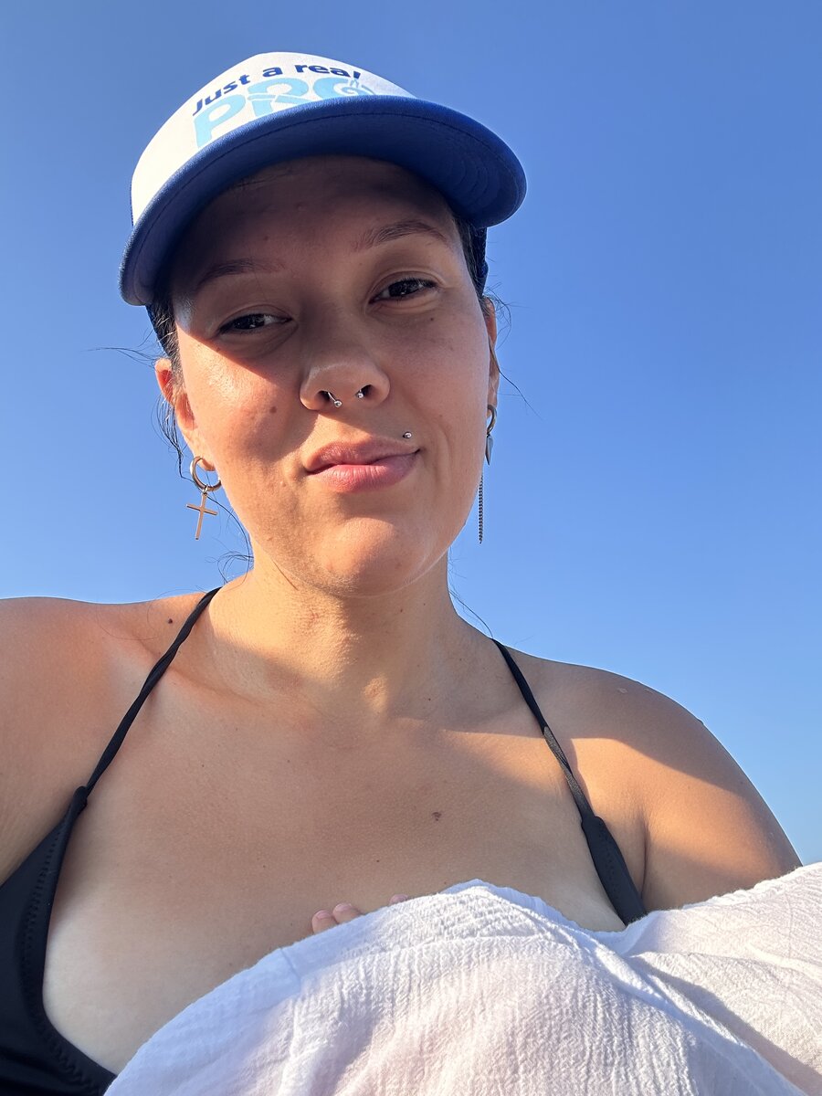 После. Разница в фото 10 месяцев