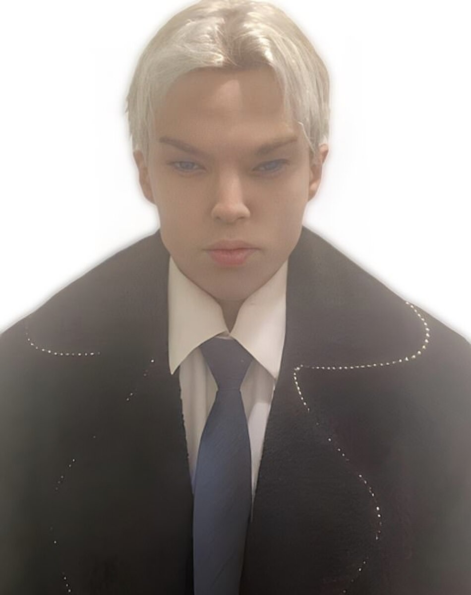    Сэйнт Вон Колуччи после пластических операций Фото: Daily Mail