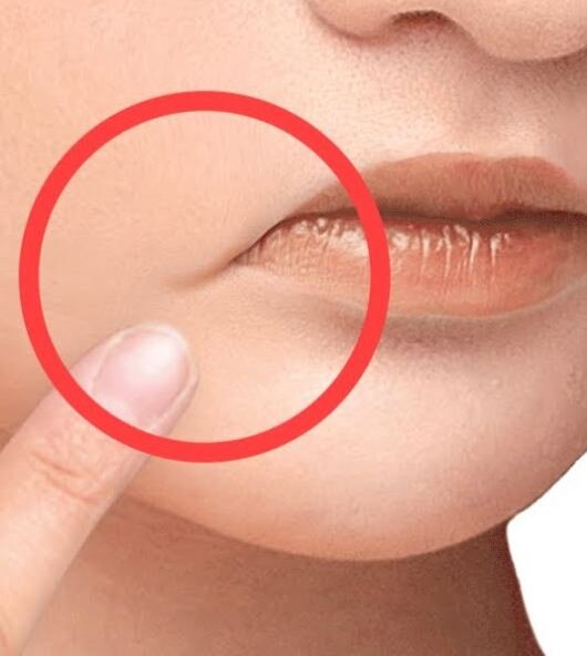 Трещины и заеды в уголках губ: причины и лечение — EVO Laboratoires