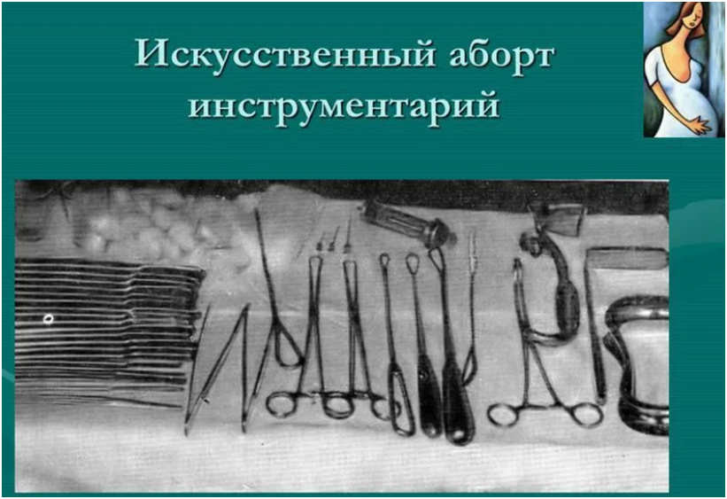 Искусственное прерывание беременности. Набор инструментария для искусственного аборта. Стерильный стол на аборт. Набор инструментов для аборта. Инструменты для хирургического аборта.