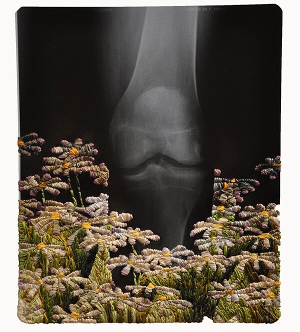 Вышивка на рентгене Источник https://demoniks.wordpress.com