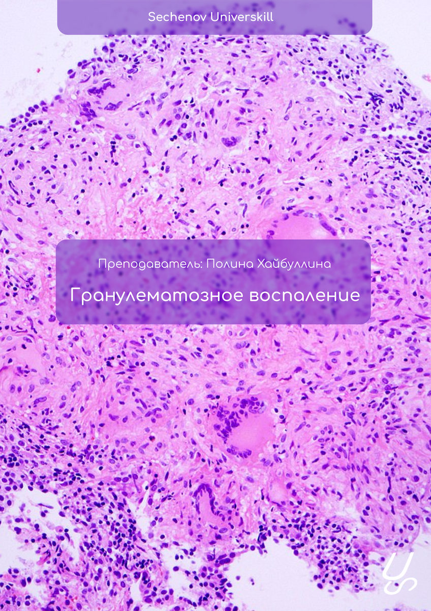 Sechenov universkill