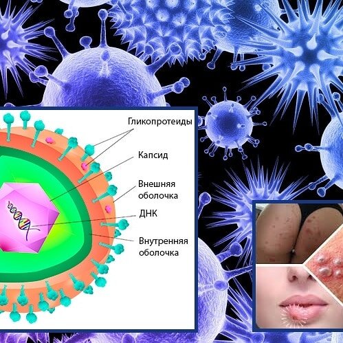 Герпес картинки вируса