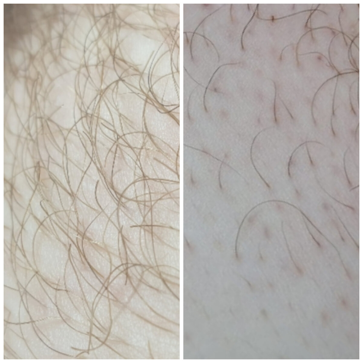 До и в процессе курса