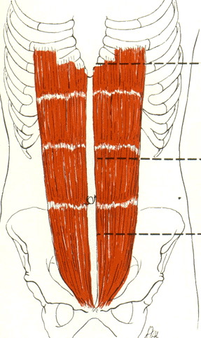 Передняя прямая мышца живота. Прямые мышцы живота. Прямая мышца. Крепление прямой мышцы живота. Начало и прикрепление прямой мышцы живота.