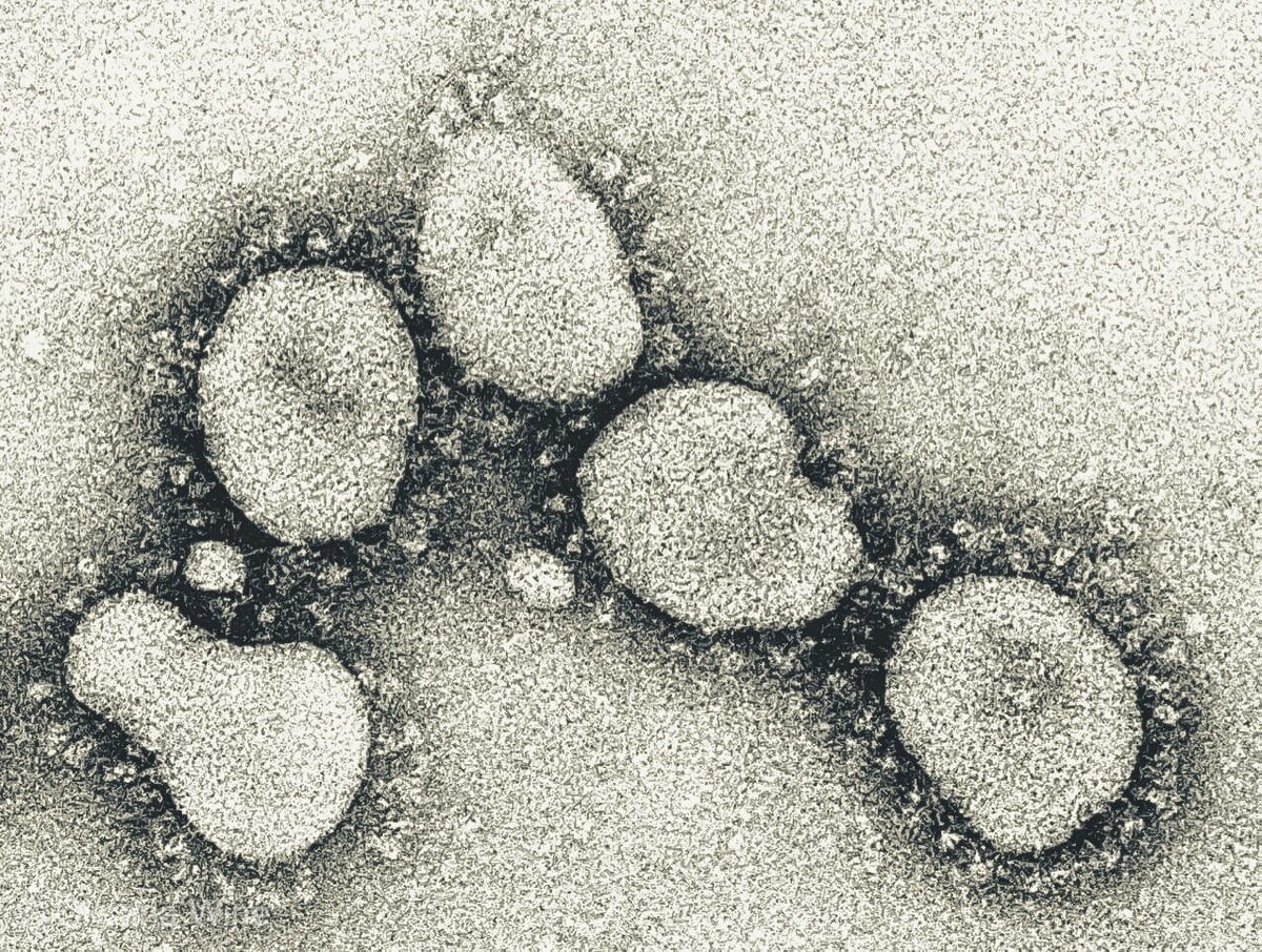 Коронавирус в микроскопе. Коронавирус под микроскопом. Вирусы. Вирус микроскопия коронавирус.