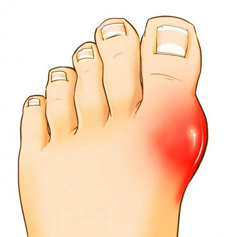 Фото взято с Яндекс Картинки.