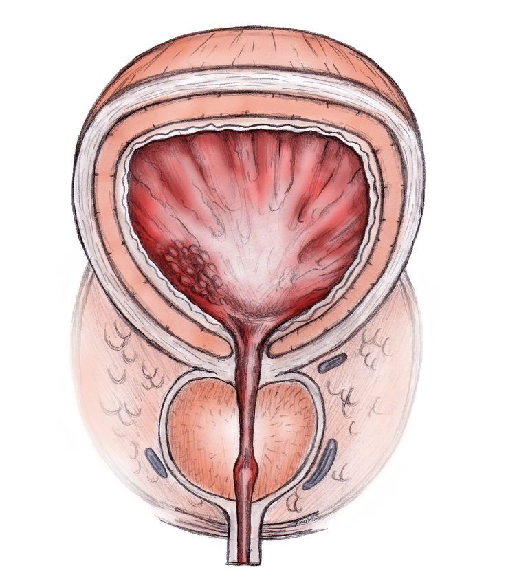 Вот такая она...