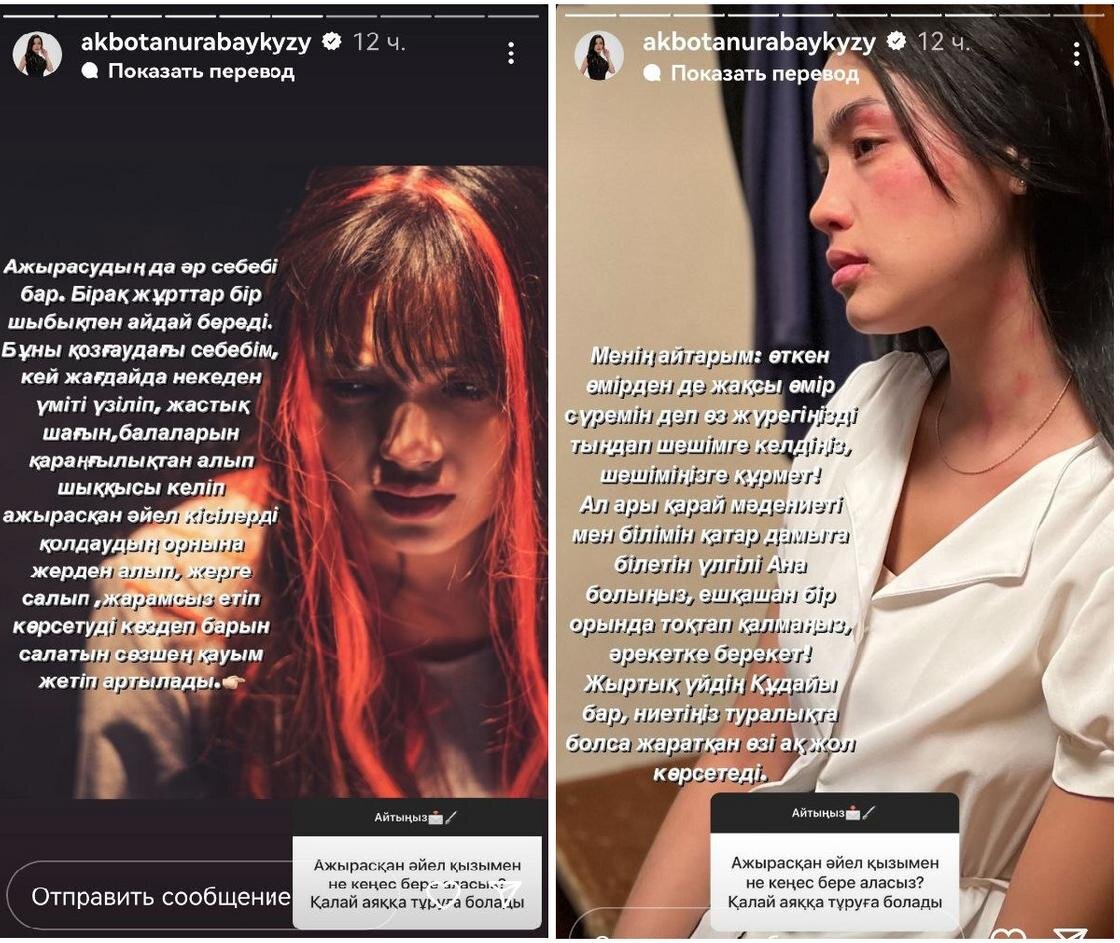    Сторис Акботы Сейтмагамбет:instagram.com/akbotanurabaykyzy