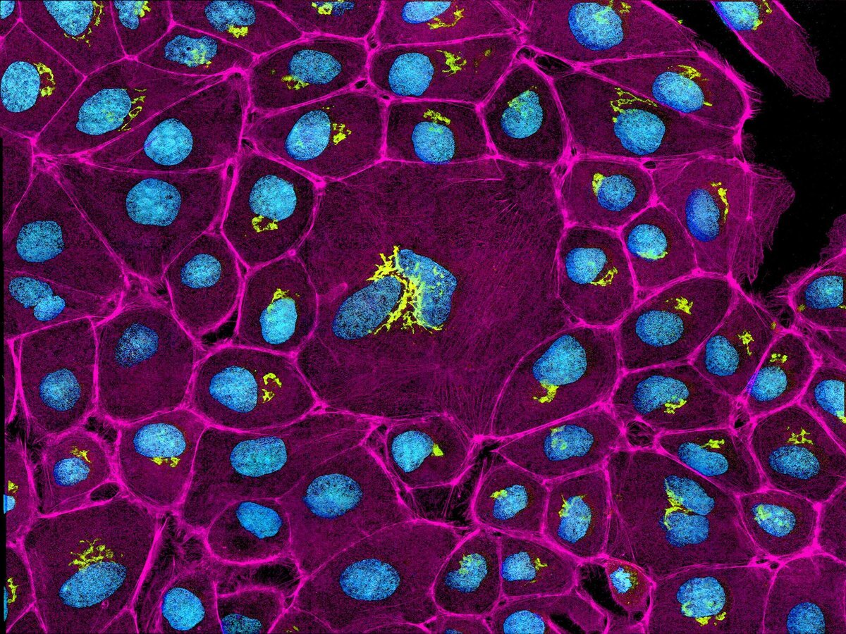 Флуоресцентная микроскопия клетка растения