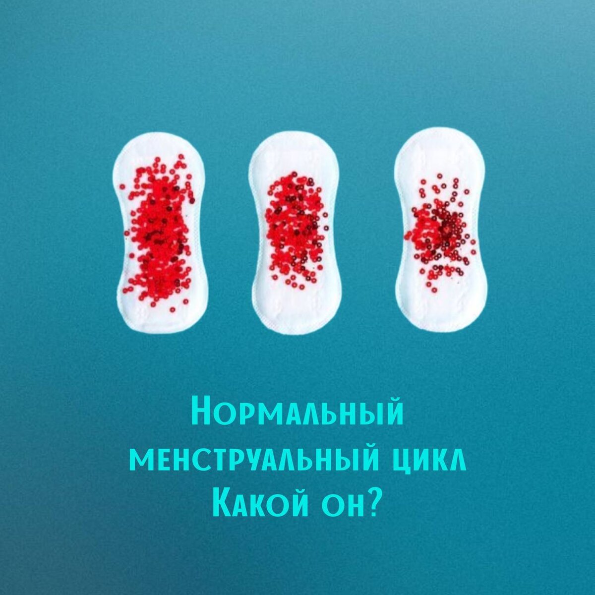 Нормальный менструальный цикл. Какой он? | ВРАЧИ-ЭНДОКРИНОЛОГИ | Proof_med  | Дзен