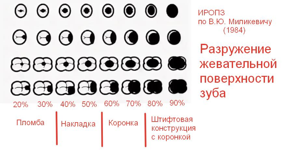 Иропз в стоматологии что это