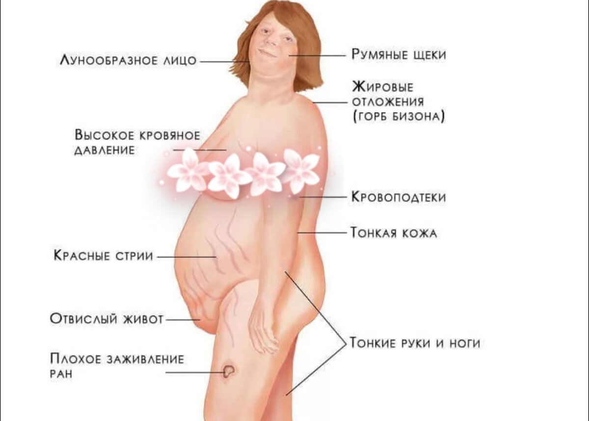 Асцит - Болезни печени и желчевыводящих путей - Справочник MSD Профессиональная версия