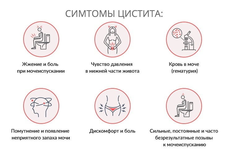 Почему не проходит цистит. Симптомы при цистите. Начальные признаки цистита. Цистит симптомы. Симптомы цистицистита.