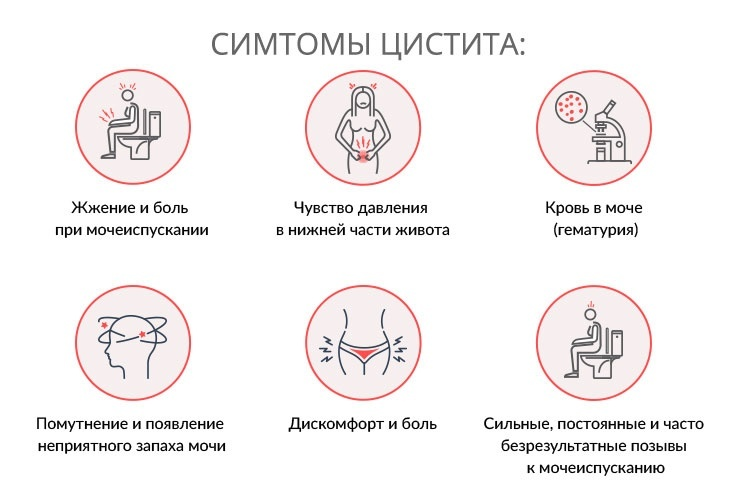 Жжение после мочеиспускания причины. Симптомы при цистите. Цистит симптомы и профилактика. Симптомы цистицистита.