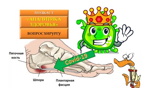 COVID 19 и боли в пятке. Пяточная шпора. Подошвенный фасциит и тендинит ахиллова сухожилия.