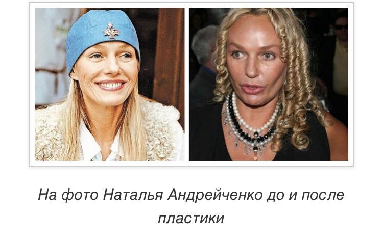 Андрейченко до и после пластики