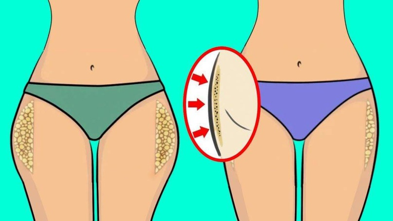 Данное изображение скачано с открытого источника "Яндекс картинки"