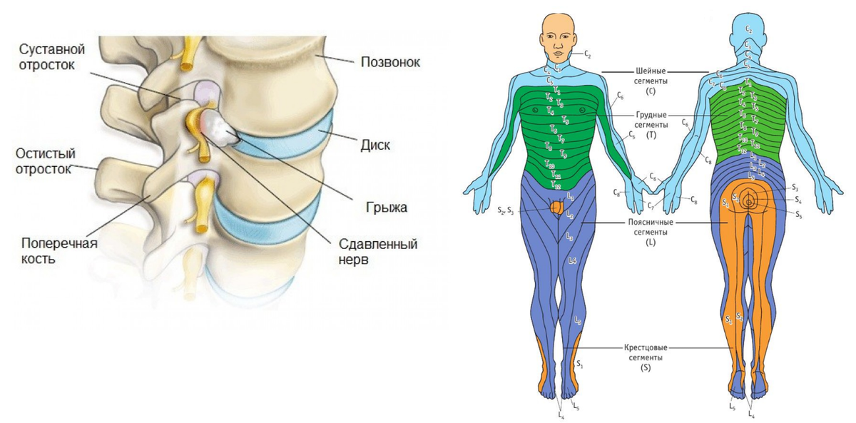 лфк для укрепления мышц спины и позвоночника упражнения. после удаления грыжи позвоночника болит ягодица. межпозвоночная грыжа операция. после удаления грыжи позвоночника болит ягодица. илья артеменко лфк.