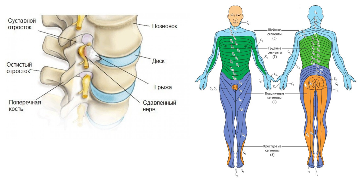 После удаления грыжи позвоночника болит ягодица