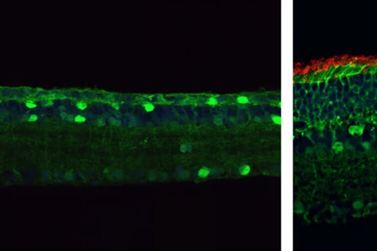     Ученые вылечили редкую патологию зрения с помощью CRISPR, вернув подопытным способность видеть
