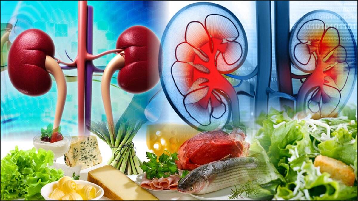 Какие продукты нужно есть для профилактики камней в почках, а какие лучше  исключить из рациона? | Как предотвратить старение | Дзен