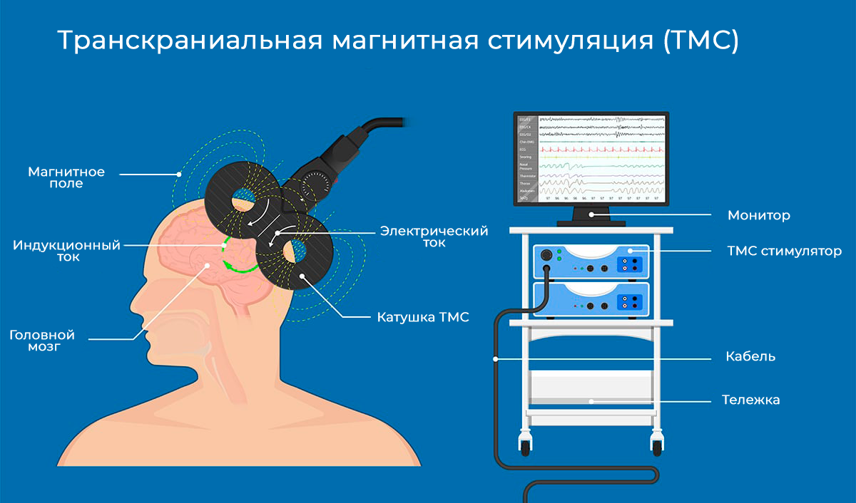 📕Аномальная латерализация при заикании | Заикание | Логоневроз | Логофобия  | Дзен