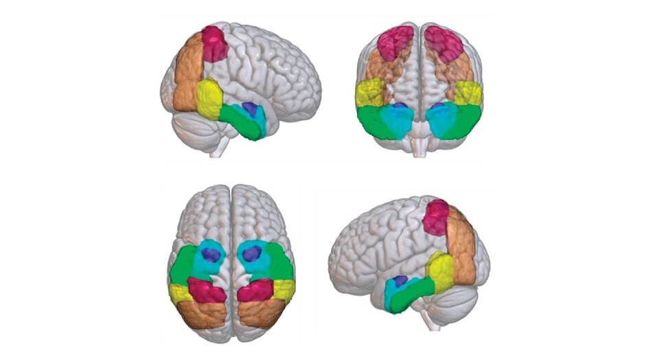   Rachel F. Buckley et al. / JAMA Neurology, 2023