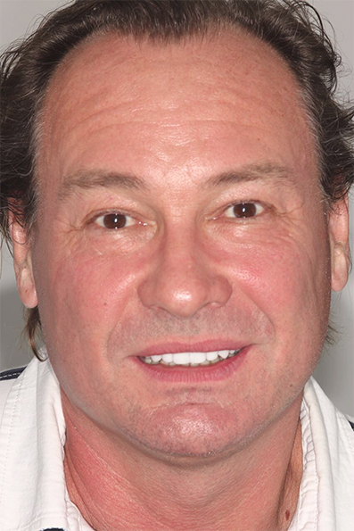 Яндекс-картинки