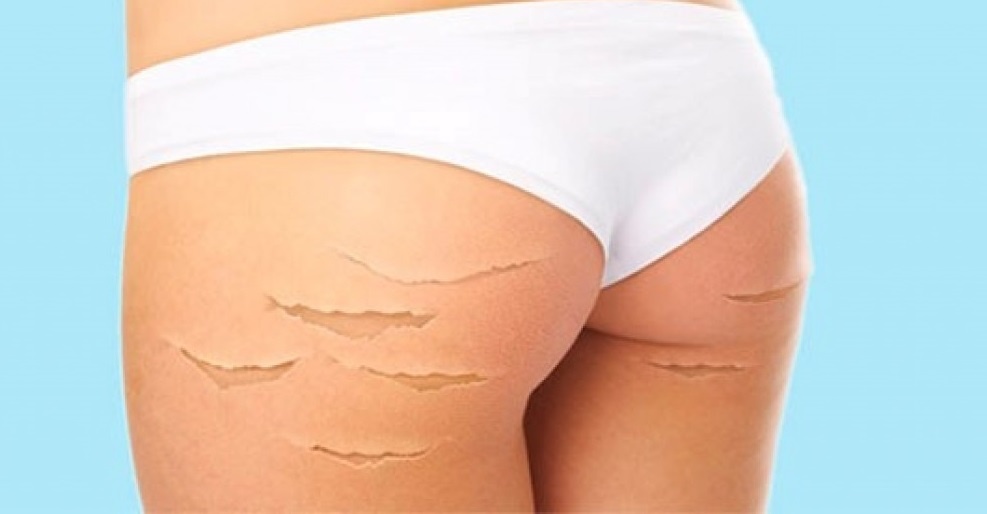 Спасибо, что выбрали мою статью! Прошу поставьте лайк и подпишитесь на канал!