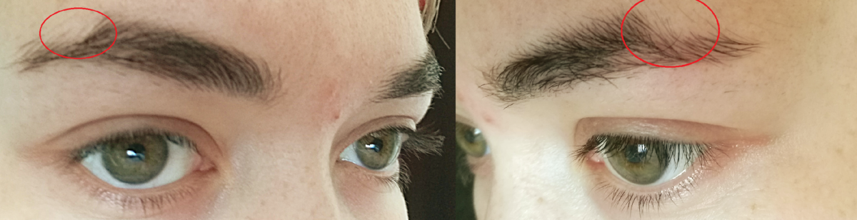 Отращивание бровей до и после. Брови до и после выщипывания. Стадии отращивания бровей. Как отрастить брови. Отращивание бровей до и после.