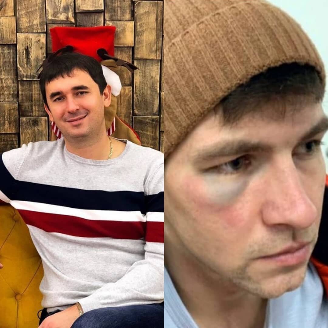 -2