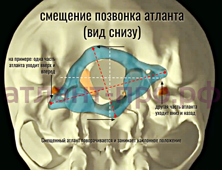 ❗️Что если АТЛАНТ не стоит на месте⁉️