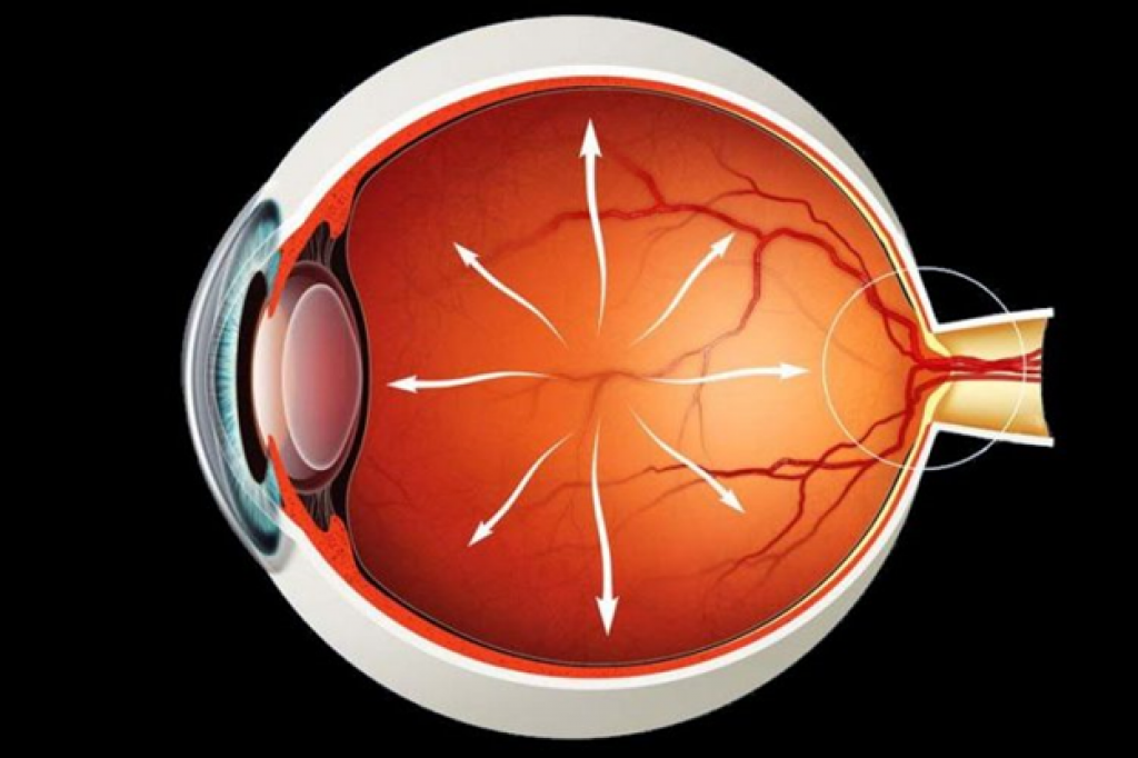 Как вылечить глаукому. Глаукома офтальмология. Пресбиопия, глаукома, катаракта, макулодистрофия.