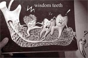 Когда начинают появляться зубы мудрости, встает вопрос — а так ли они необходимы человеку?