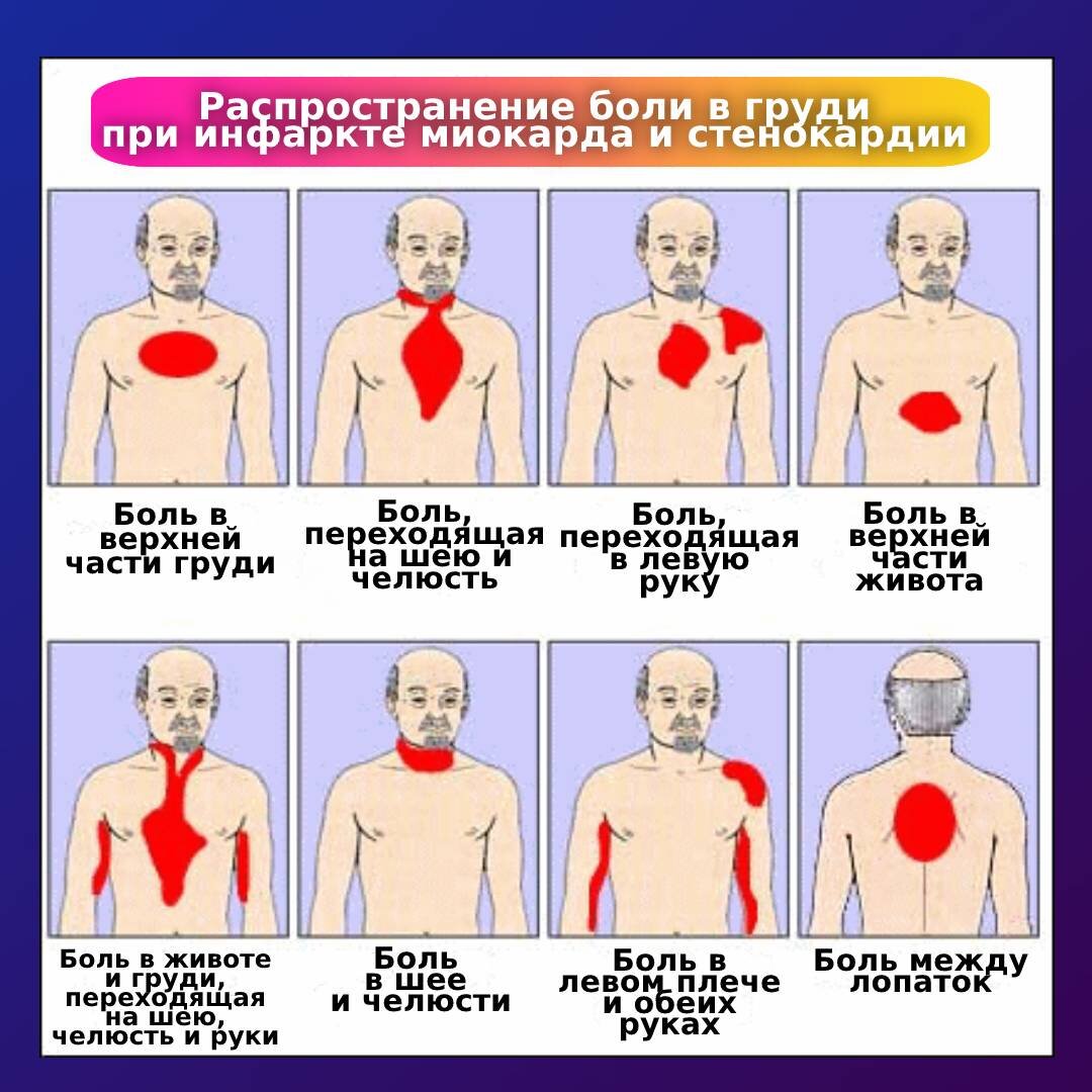Болит в груди – это инфаркт? Ответ кардиолога | Доктор Утин, кардиопоэт |  Дзен