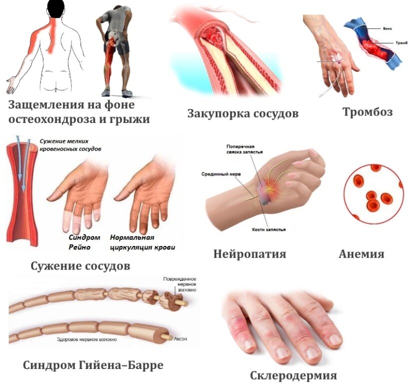 Физиологические причины онемения пальцев на руках