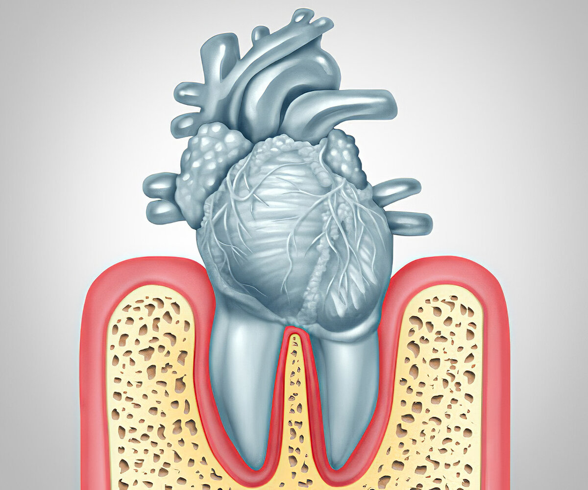 Как связаны сердце и зубы