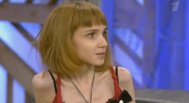 Весила всего 17 кг. Как сегодня выглядит победившая анорексию Кристина Корягина 