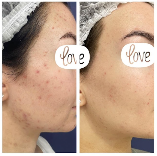 Работа врача Демидион Дианы Клиника Премиум Эстетикс, Москва