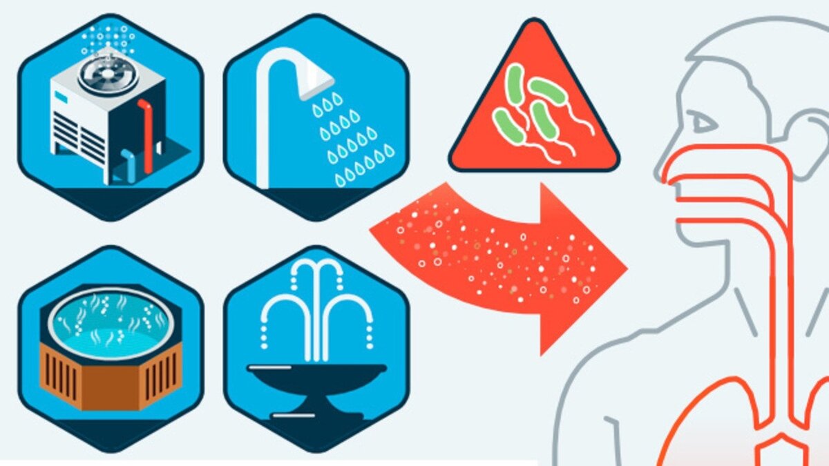 Пути передачи легионеллёза