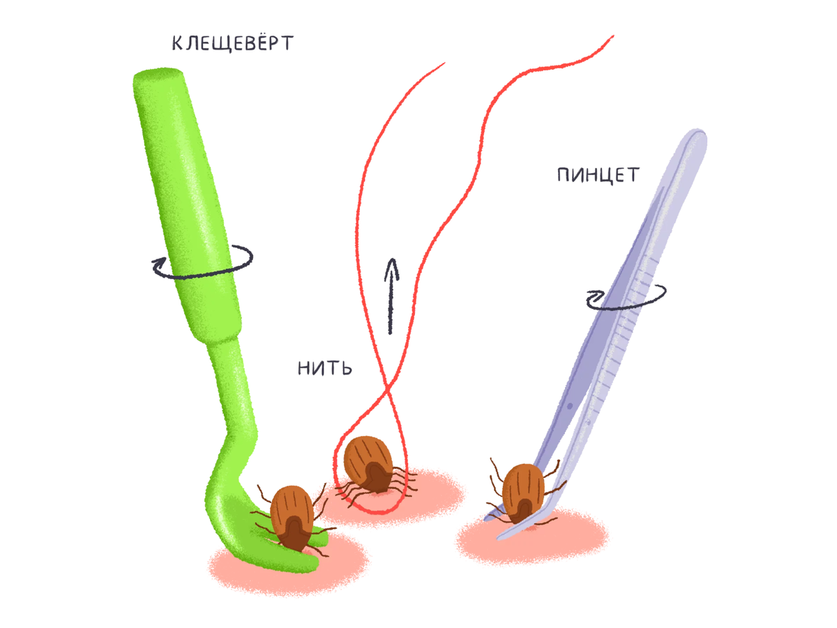 Нашествие клещей в лесах России! Как защитить себя и детей. И что делать,  если клещ всё-таки укусил | Зелёный вектор | Дзен