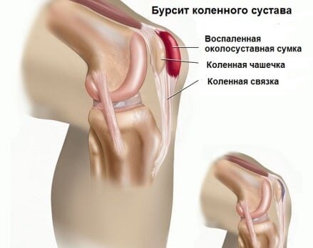 Записки мануального терапевта: как самостоятельно избавиться от боли в спине.