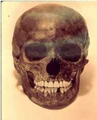 Череп, обнаруженный охотниками в лесу.