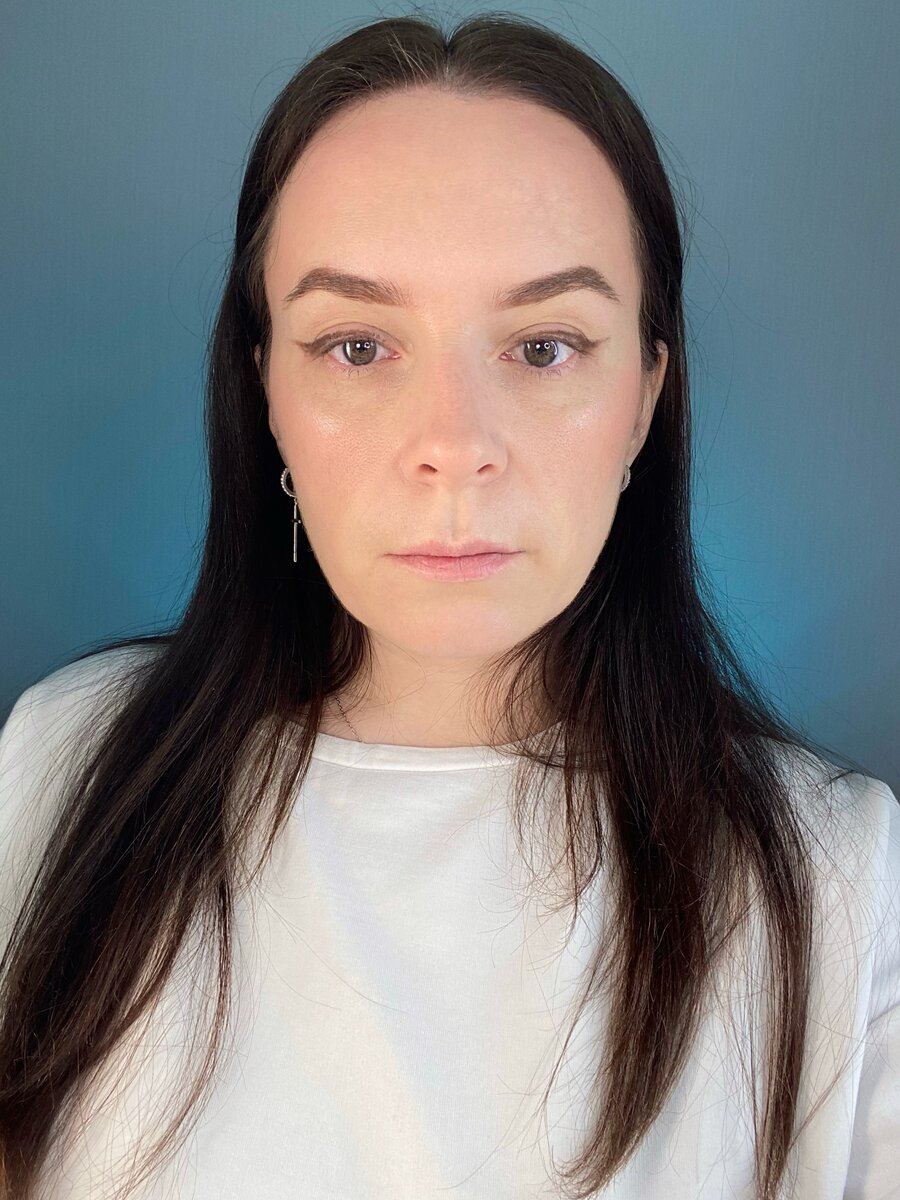 Стрелка с проплешинами 